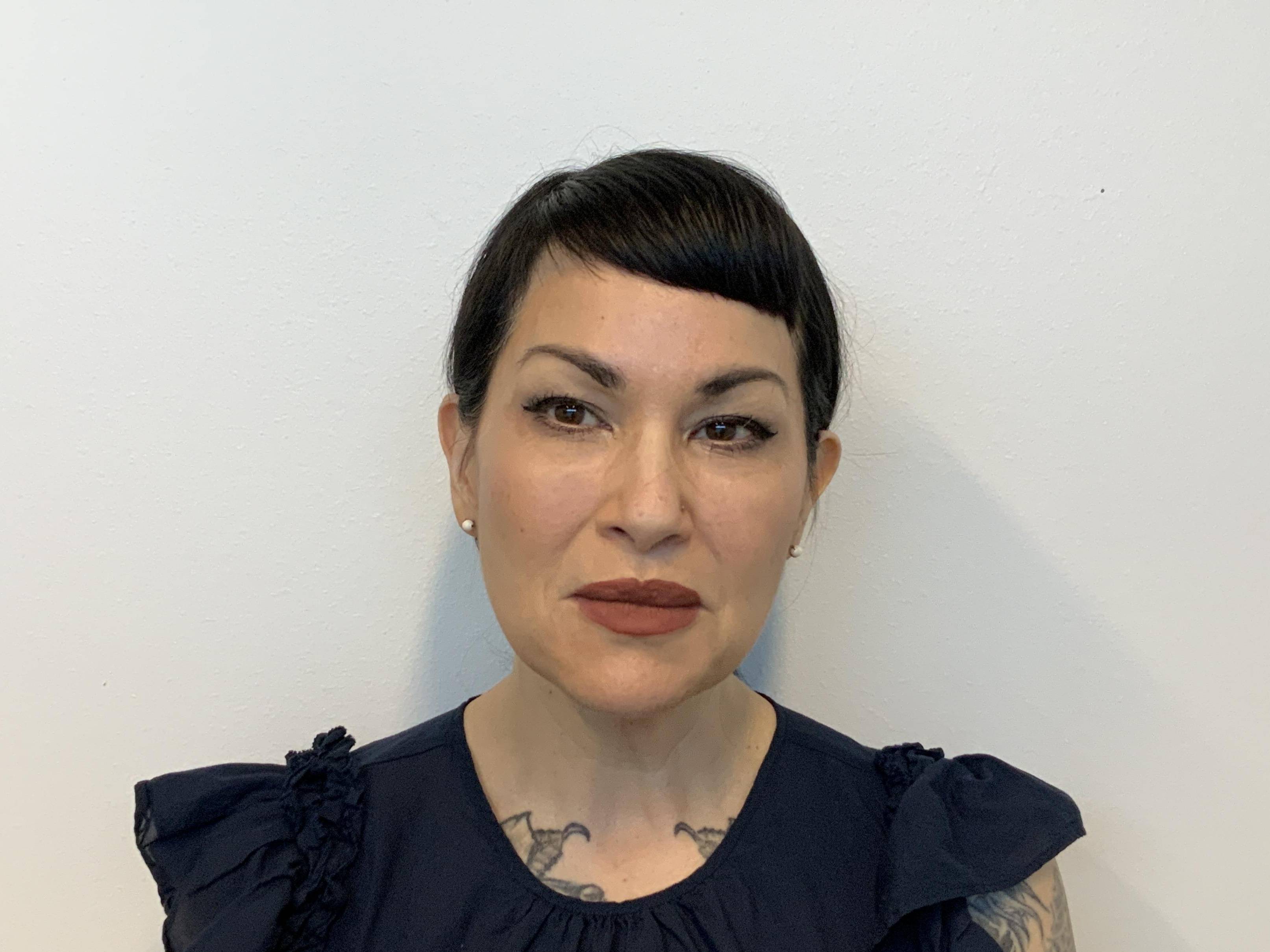 Facelift and Necklift Before