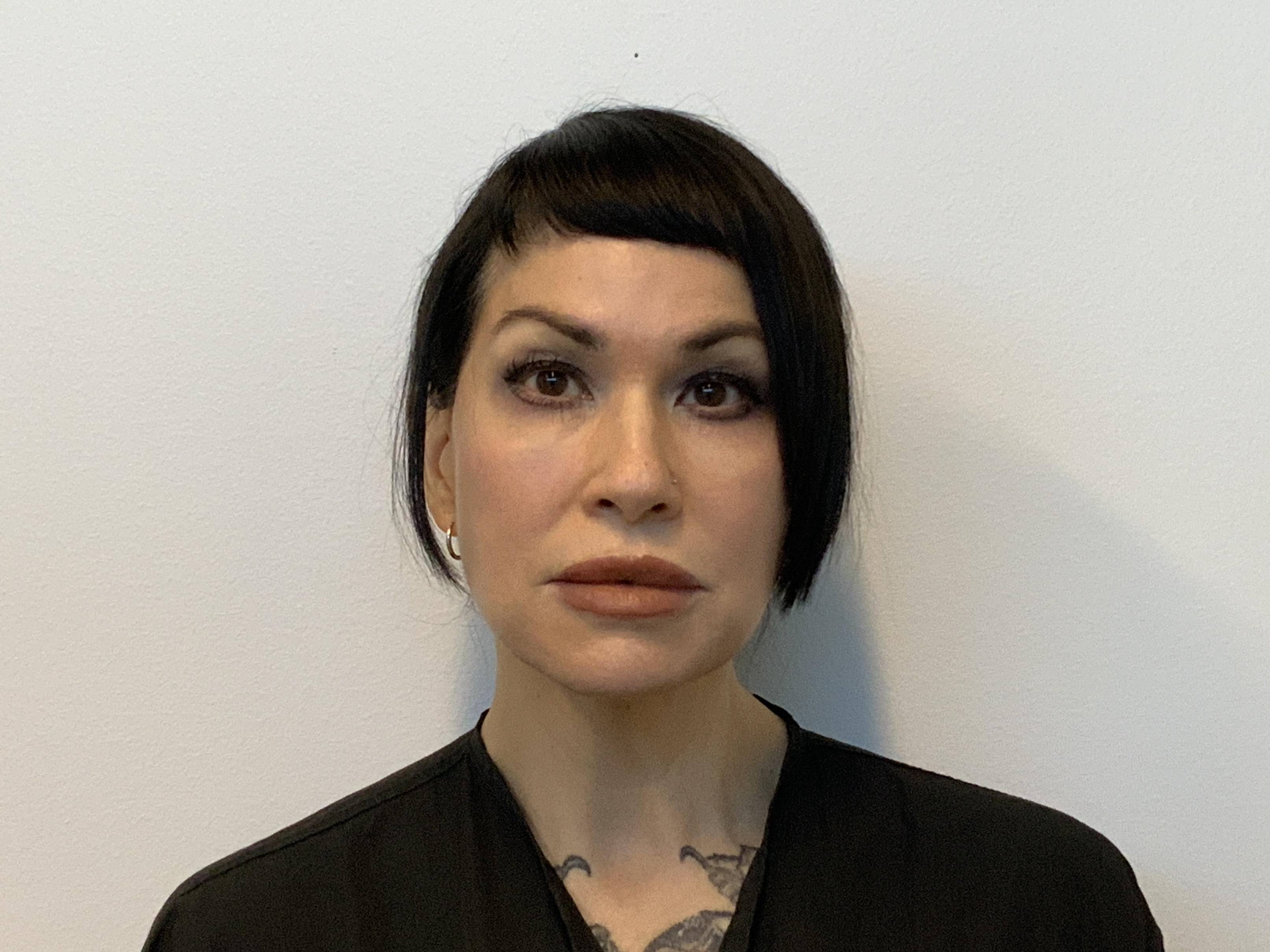 Facelift and Necklift After