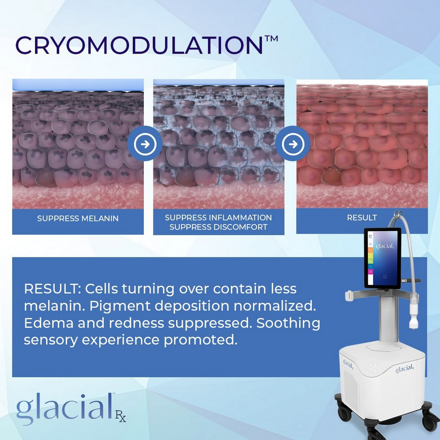 How GlacialRX works diagram