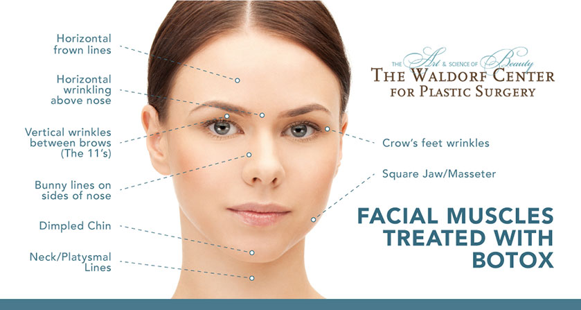 Portland's Waldorf Center for Plastic Surgery uses BOTOX® for a range of cosmetic applications on the face and neck.