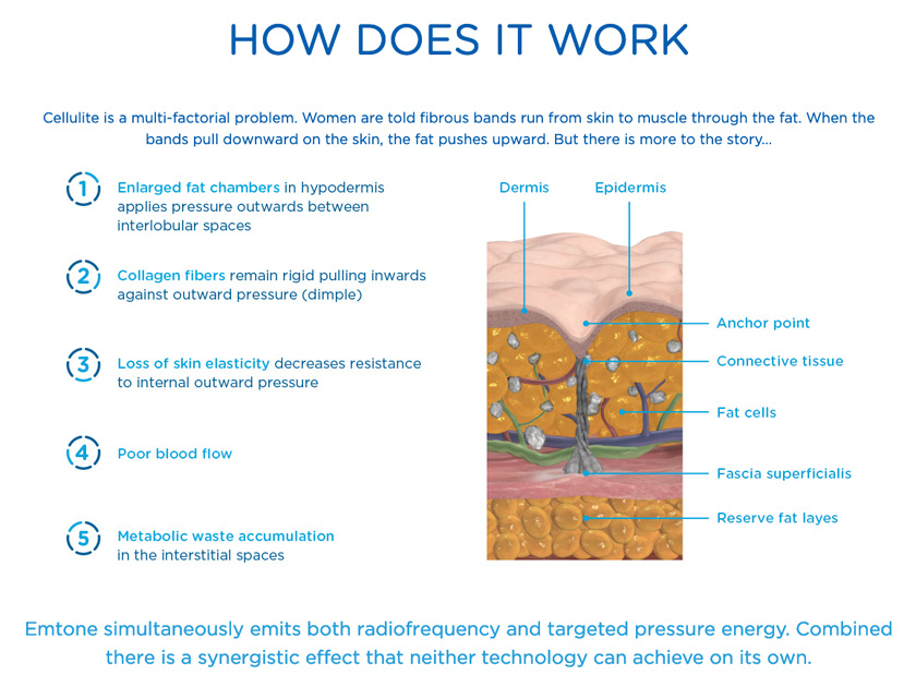 How does Emtone work?