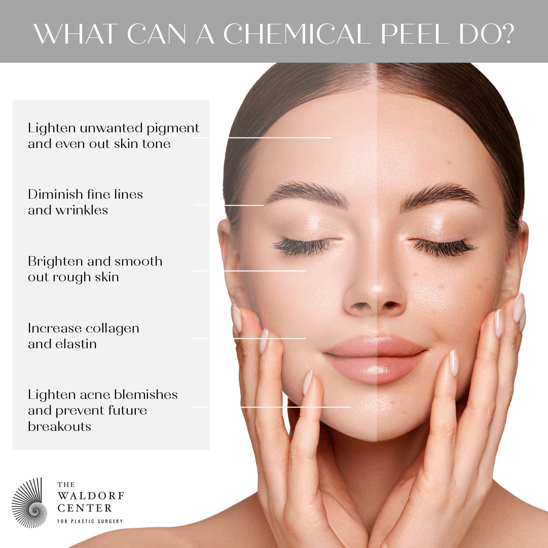 See the benefits of a chemical peel at Portland’s Waldorf Center.